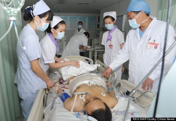 Worlds Largest Tumour Weighing 110kg Removed From Yang Jianbins 4824