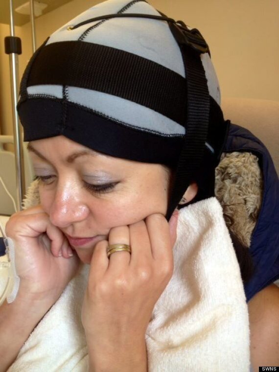 freezing hair during chemo