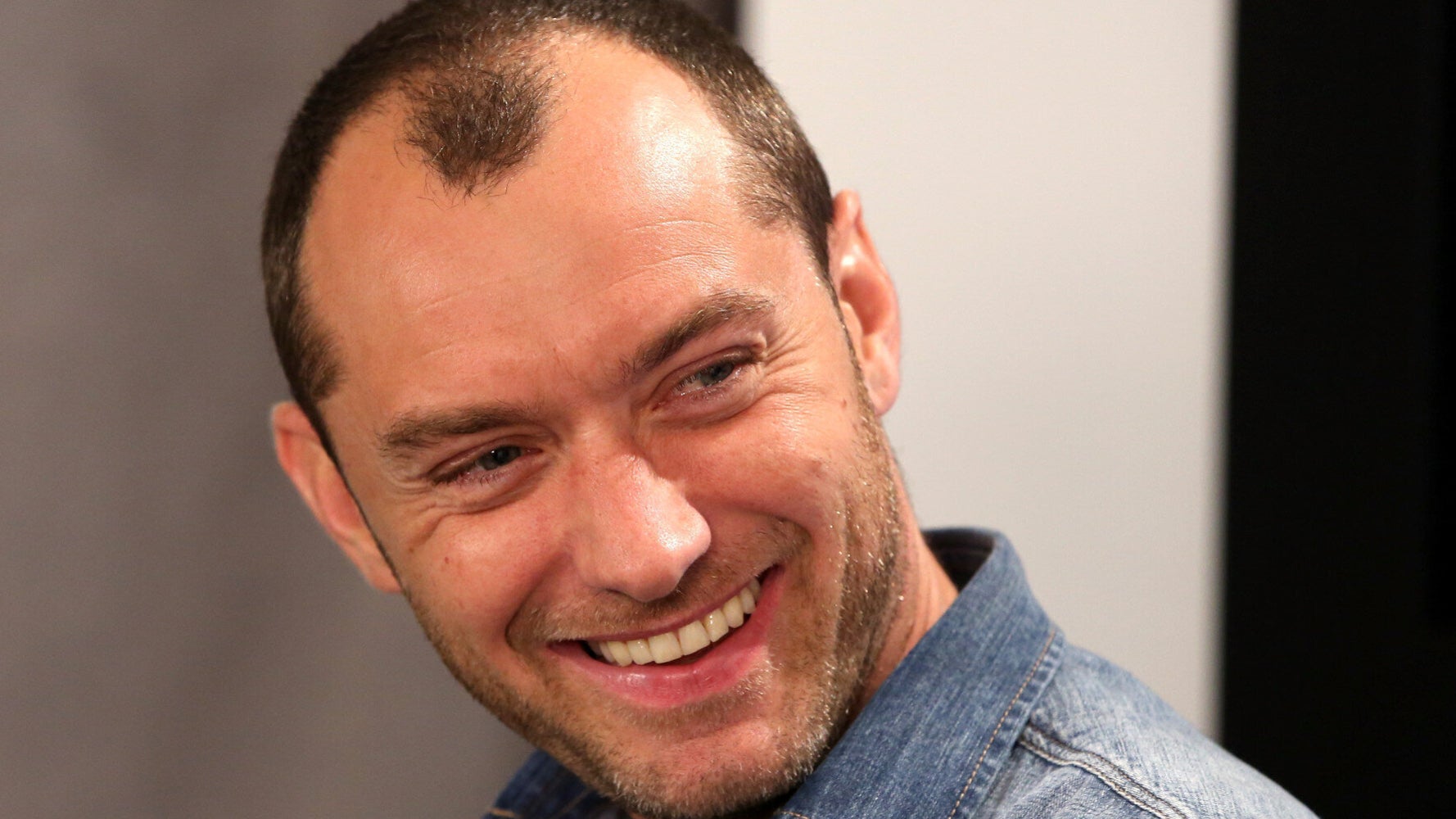 Hey Jude Treating Male Hair Loss Has Never Been Easier Huffpost