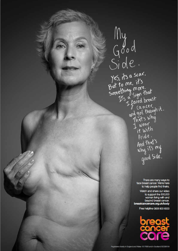 Body image and breast cancer