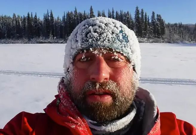 Nick Griffiths lost his big toe taking part in the Yukon Arctic ultra-marathon last year 