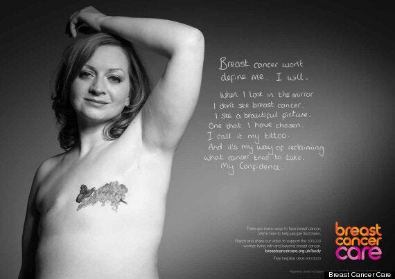 I Had My Breasts Removed. I Didn't Realize It Would Affect Me The