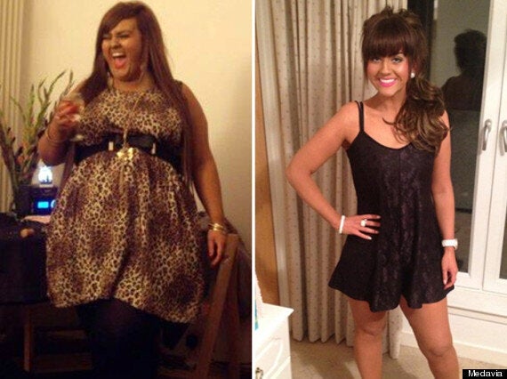 Woman 25 Loses Nine Stone After Dad Pays £10000 For Private Weight Loss Surgery Huffpost Uk 