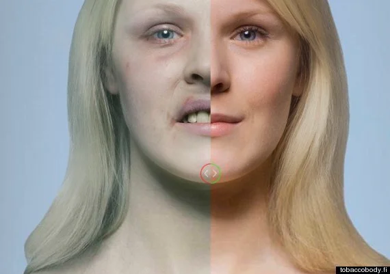 Stoptober: If These Gross Pictures Of What Smoking Does To You Doesn't Make You Quit, What Will? (PHOTOS) | HuffPost UK Life Stoptober: If These Gross Pictures Of What Smoking Does To You Doesn't Make You Quit, What Will? (PHOTOS) | HuffPost UK Life