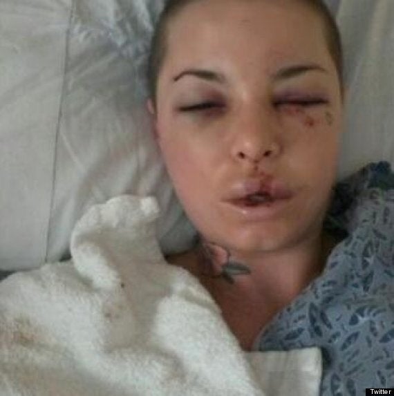 War Machine' Wanted in Brutal Beating of Porn Star