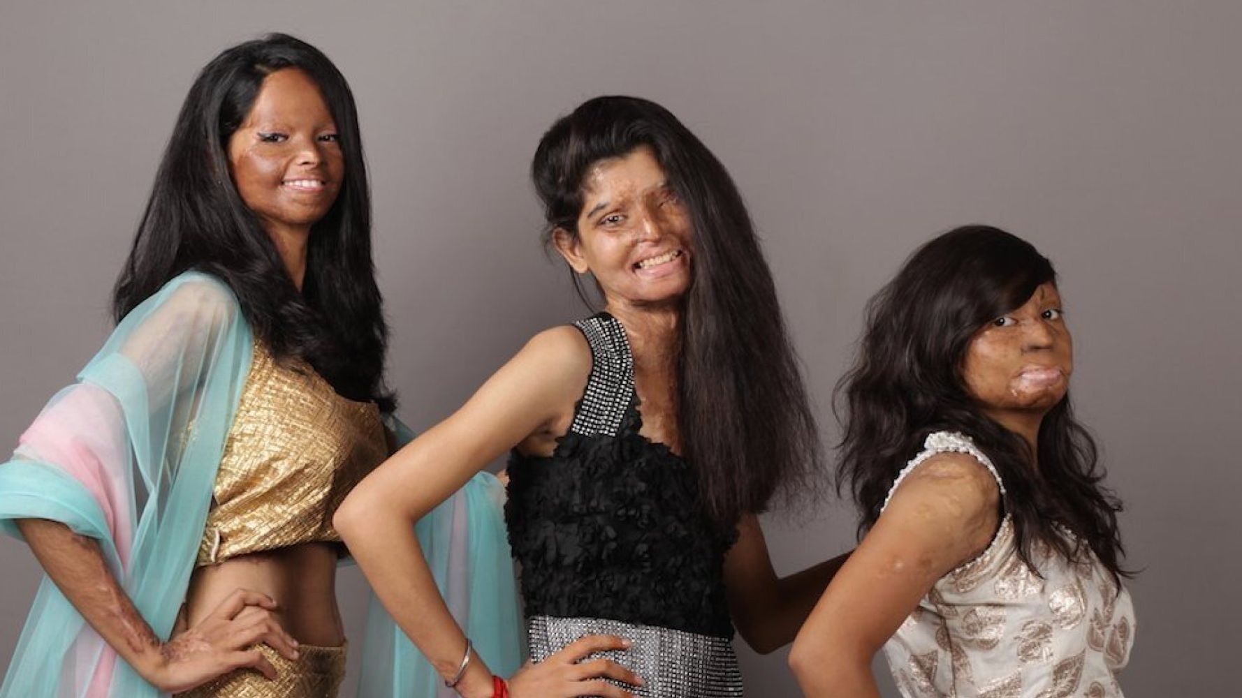 Indian Acid Attack Victims Bravely Star In Empowering Photoshoot Huffpost Uk Life