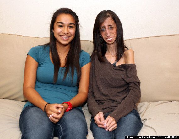 Worlds Thinnest Woman Lizzie Velasquez Who Has A Medical Condition Has Started An 