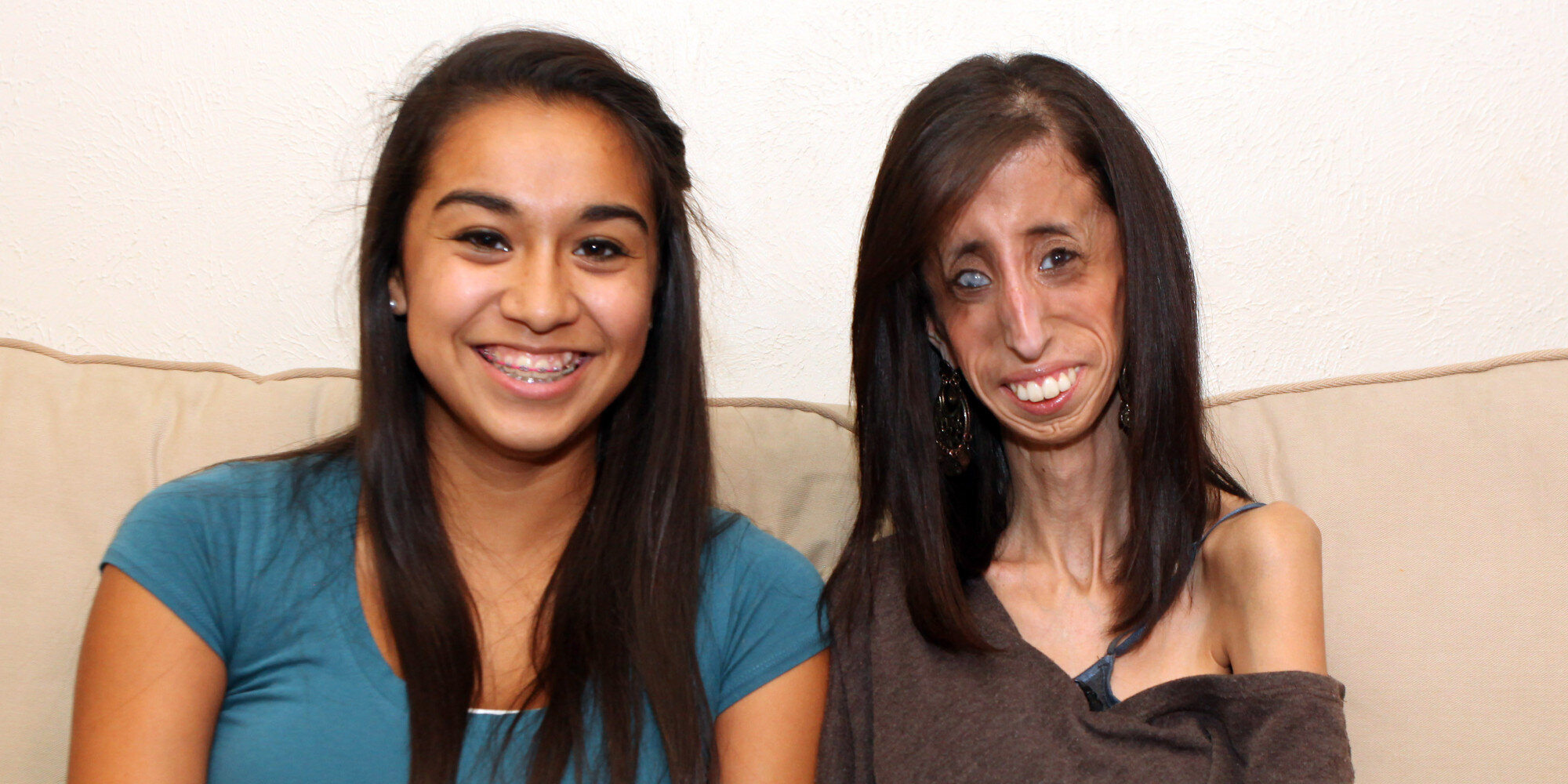 World S Thinnest Woman Lizzie Velasquez Who Has A Medical Condition   5d0253162500004e12e4fb17 