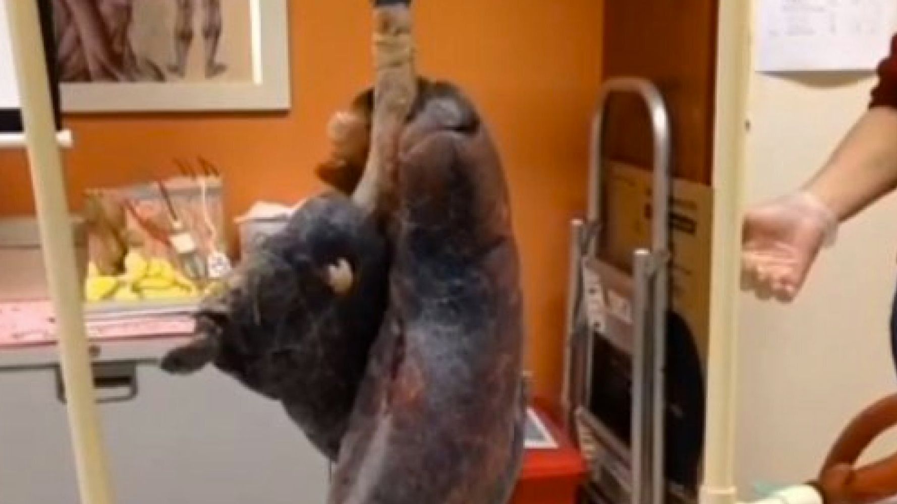 Health Risks Of Smoking This Video Of Smoker S Lungs Will