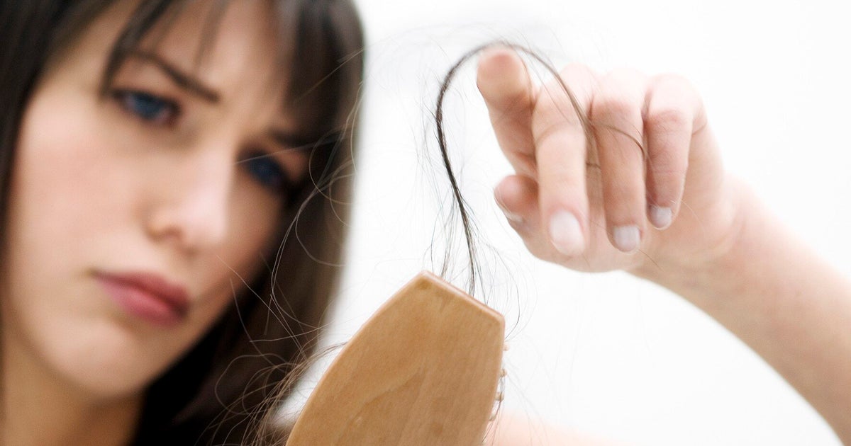 Timelapse Video of 18 Months of Hair Growth After Chemotherapy