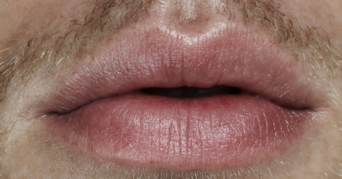 Mouth Cancer Symptoms Treatment And Risk Factors Explained Huffpost Uk