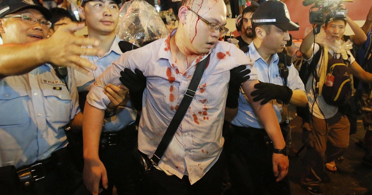 Hong Kong's Peaceful Protesters Left Bloodied By Mobs As Police Deny