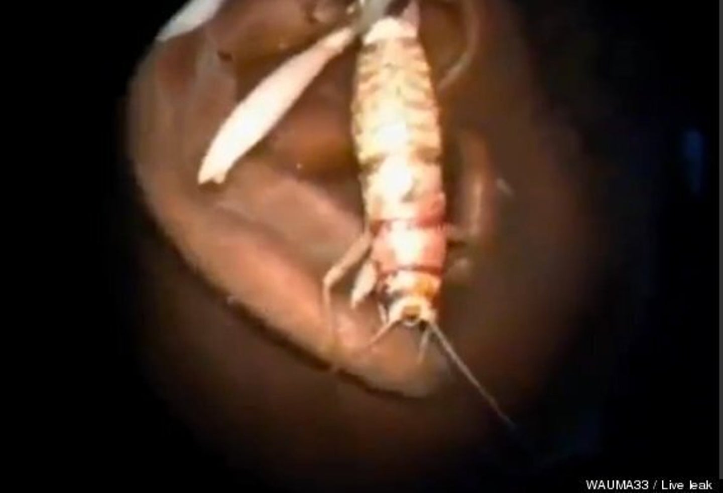 Live Three-Inch Cricket Found In Man's Ear By Doctors | HuffPost UK Life