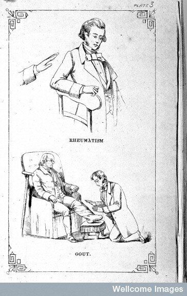 Rheumatism and gout being treated by mesmerism