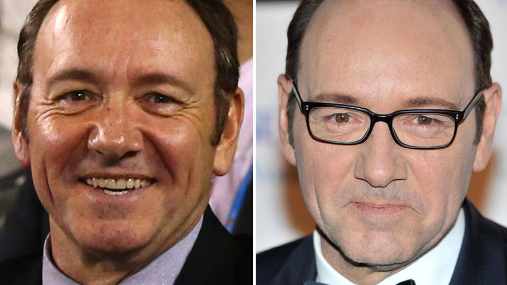 Kevin Spacey Hair Transplant? Actor Sports Thicker Thatch At Australian Open (PICS) | HuffPost UK News Kevin Spacey Hair Transplant? Actor Sports Thicker Thatch At Australian Open (PICS) | HuffPost UK News