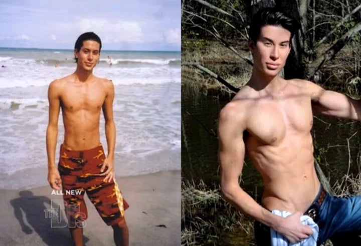 Justin Jedlica Human Ken Doll With Buttock And Pectoral Implants