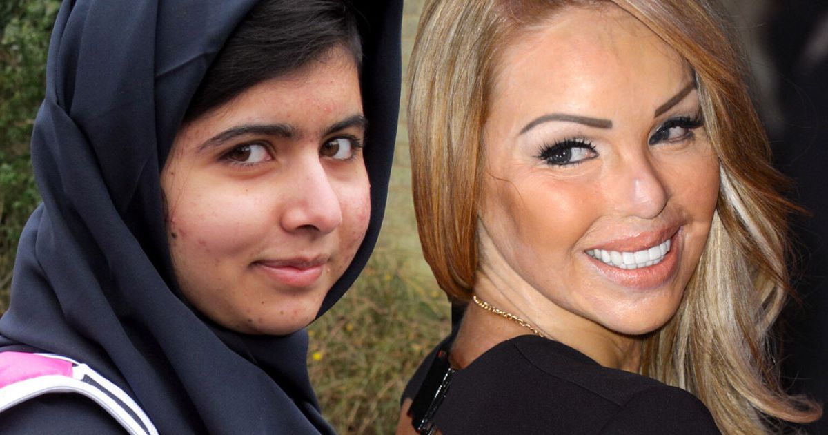 Plastic Surgery Miracles Katie Piper Malala Yousafzai And Other