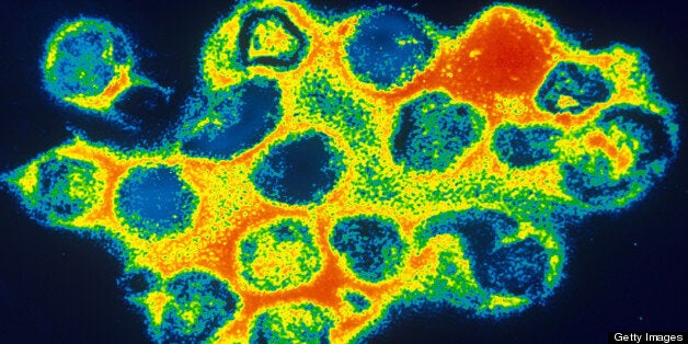 Negative stain transmission electron micrograph of Rubella virus, commonly known as German measles.