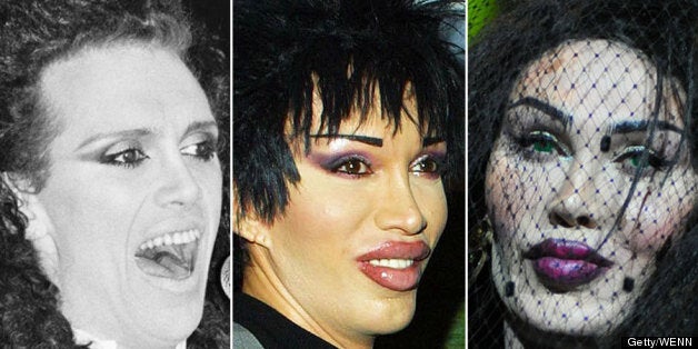 Pete Burns, the controversial singer of the band Dead Or Alive