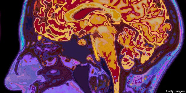 Dr Kathleen Taylor was responding to questions about advances in neuroscience (file