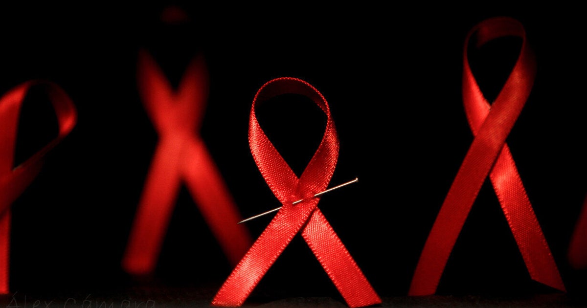 HIV/AIDS The Australian Response HuffPost UK Life
