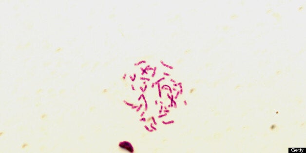 Turner syndrome usually occurs when sex chromosomes fail to separate during the formation of an egg or sperm