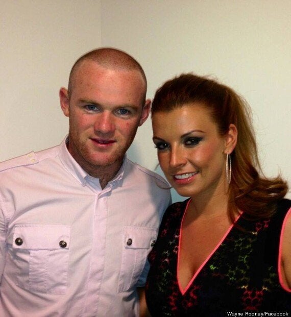 Wayne Rooney Shows Off Results Of Second Hair Transplant On Facebook (PICTURE) | HuffPost UK Entertainment Wayne Rooney Shows Off Results Of Second Hair Transplant On Facebook (PICTURE) | HuffPost UK Entertainment