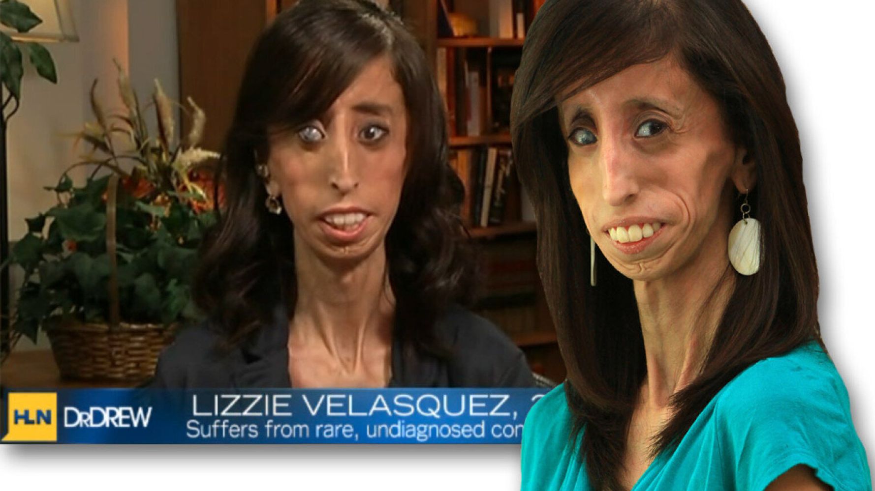 Lizzie Velasquez Answers Bullies Who Branded Her The World S Ugliest Woman Pictures
