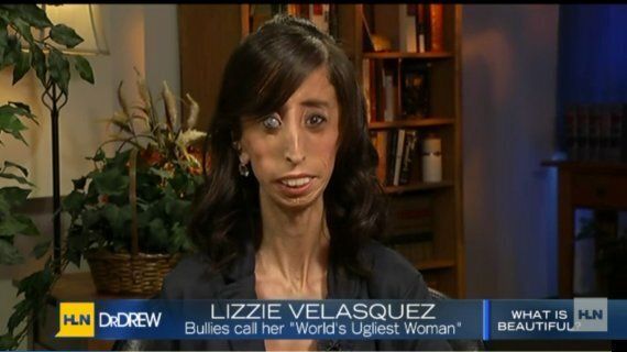 Lizzie Velasquez Answers Bullies Who Branded Her The Worlds Ugliest 