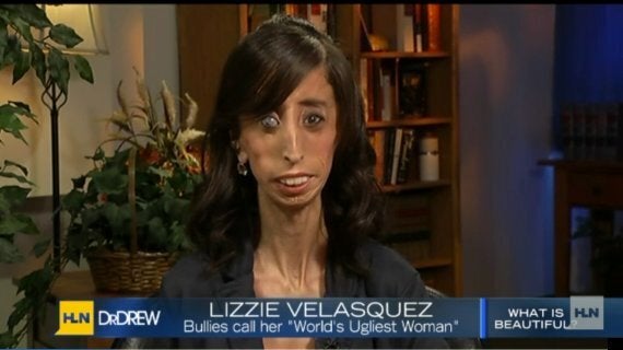 Lizzie Velasquez Answers Bullies Who Branded Her The Worlds Ugliest 