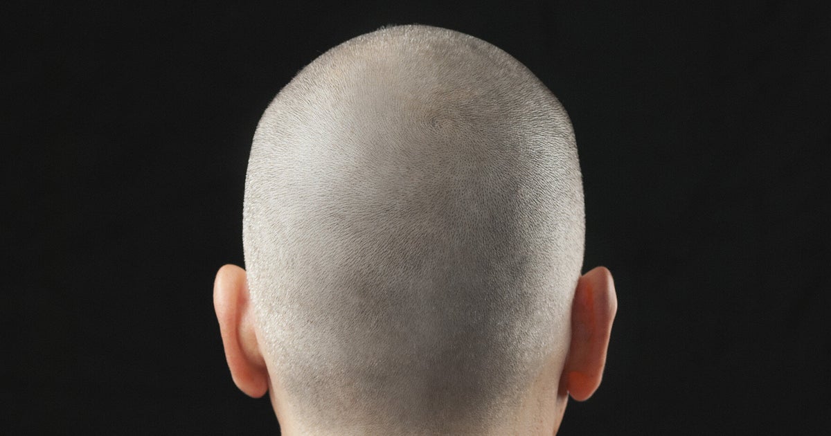 The Real Cost Of The Booming Scalp Tattoo Industry Huffpost Uk