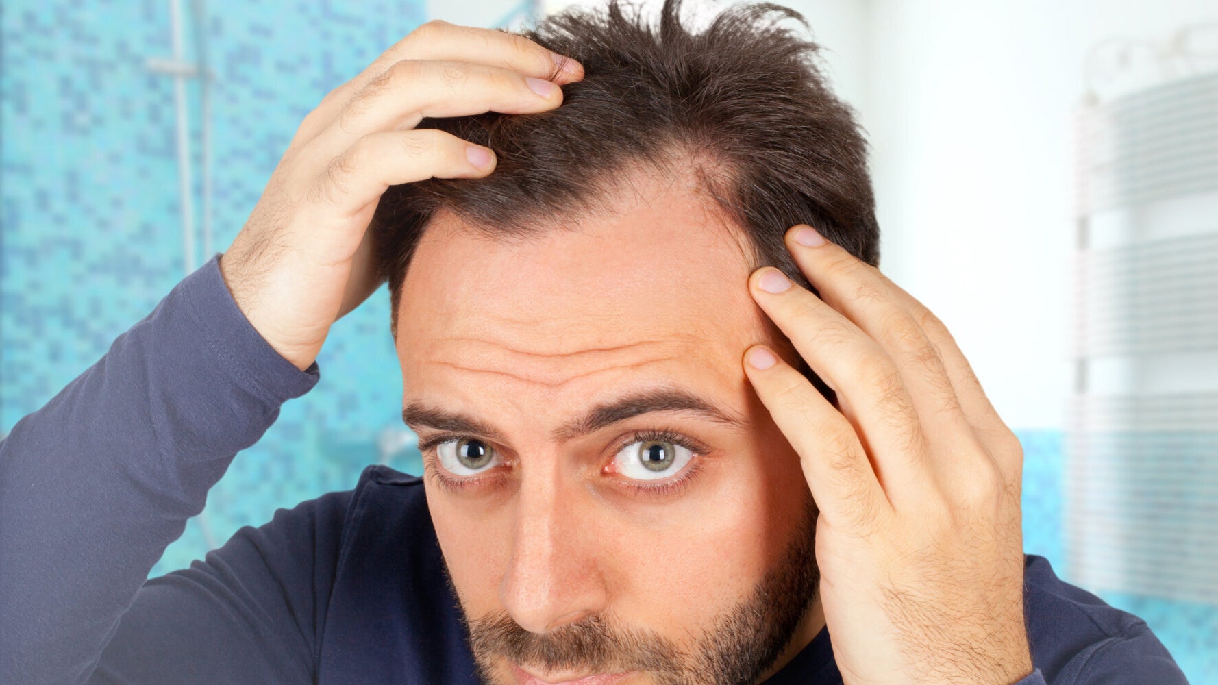 How Young Is Too Young For A Hair Transplant? | HuffPost UK Life How Young Is Too Young For A Hair Transplant? | HuffPost UK Life