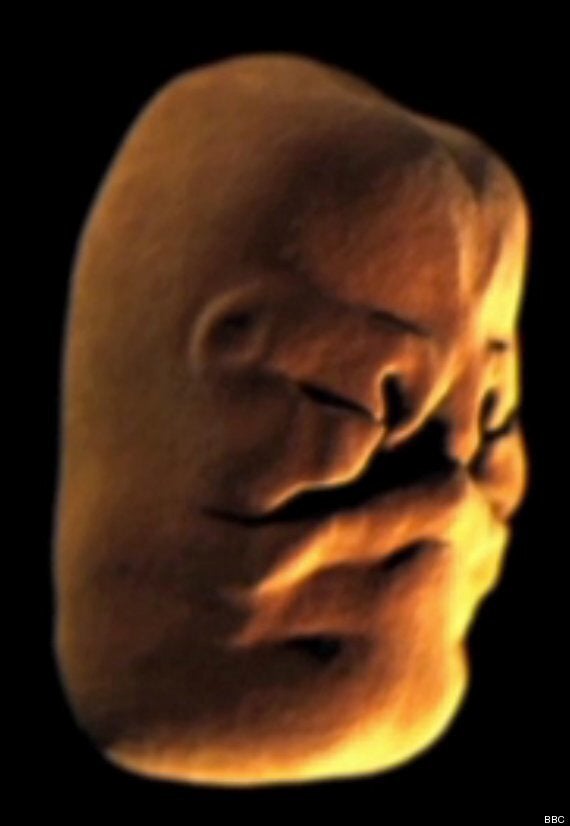 How The Face Forms In The Womb: Time Lapse Animation Reveals Embryo's Development (VIDEO) | HuffPost UK News How The Face Forms In The Womb: Time Lapse Animation Reveals Embryo's Development (VIDEO) | HuffPost UK News