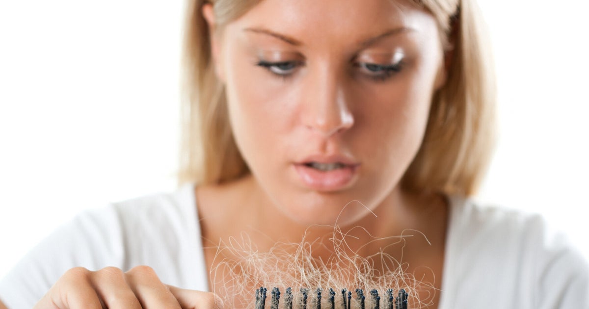 Why Do People Lose Hair And What Can Be Done About It? HuffPost UK Life