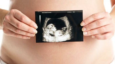 baby scan