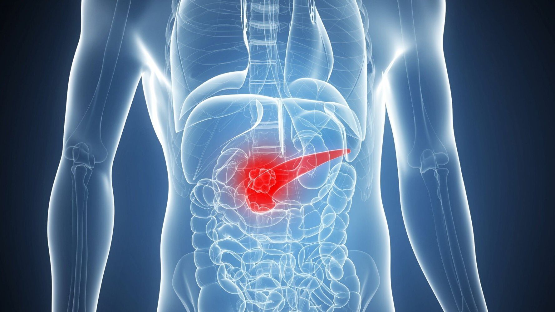 Pancreatic Cancer: The Wound That Never Heals | HuffPost UK Life