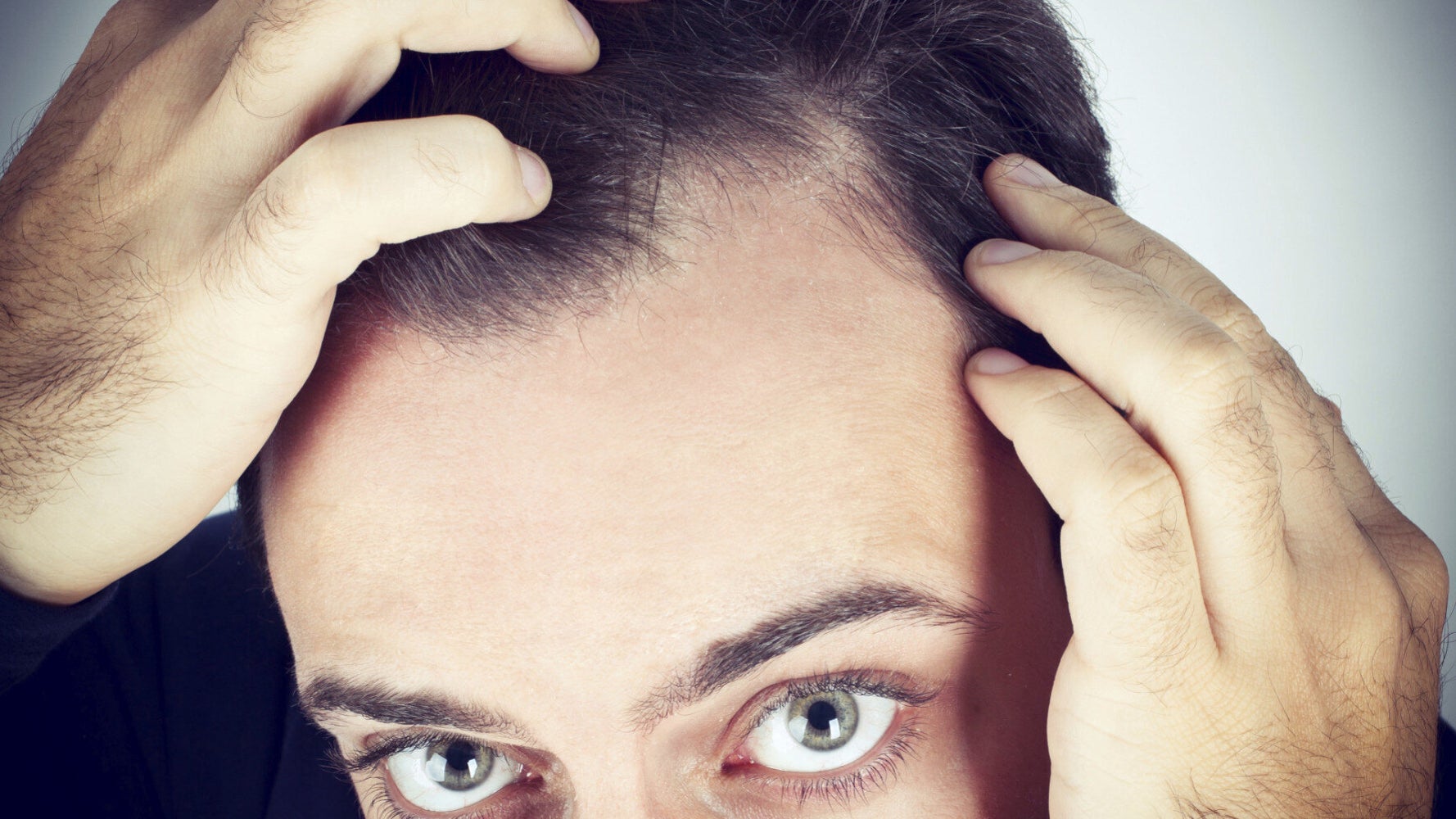 Bald and Under Thirty: Hiding the Truth and Hiding From the Truth | HuffPost UK Life Bald and Under Thirty: Hiding the Truth and Hiding From the Truth | HuffPost UK Life