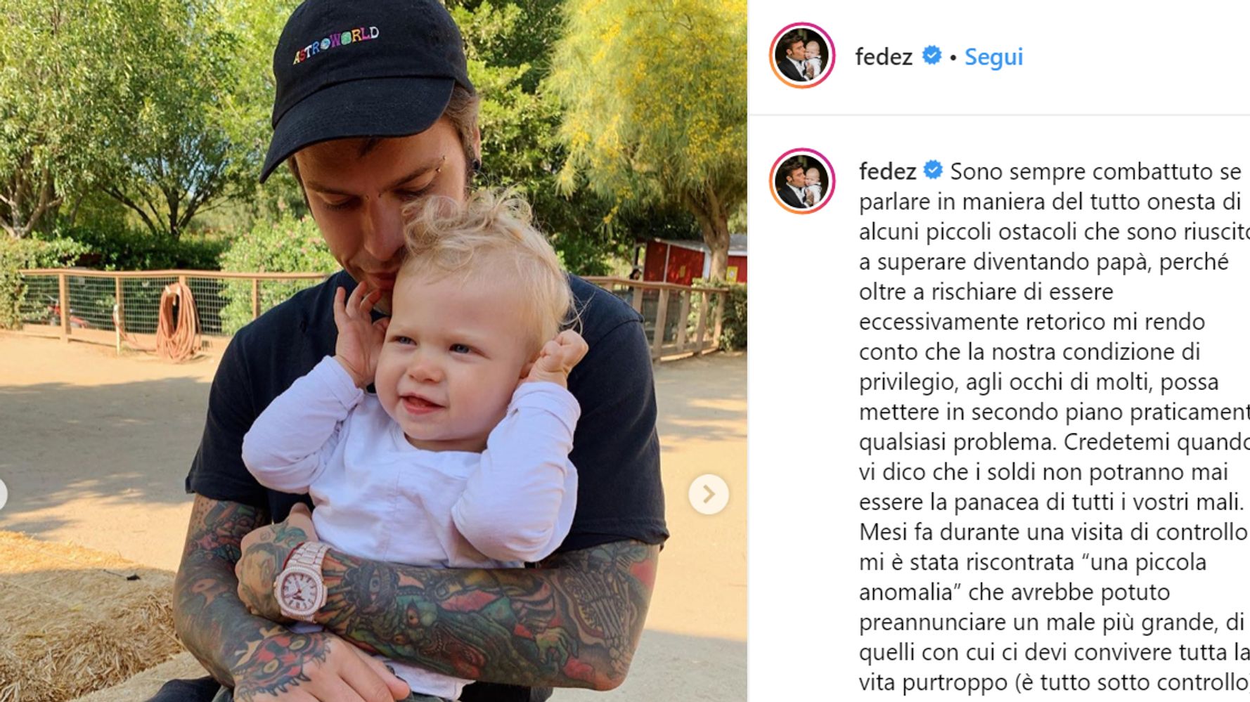 fedez mi e stata riscontrata una piccola anomalia l huffpost