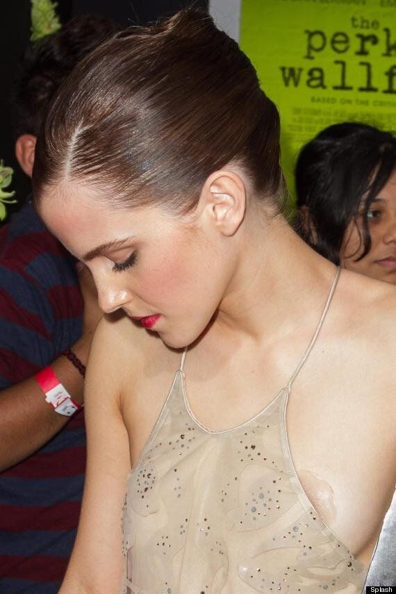 Emma Watson Narrowly Avoids A Nip Slip Thanks To Stick-On Jelly