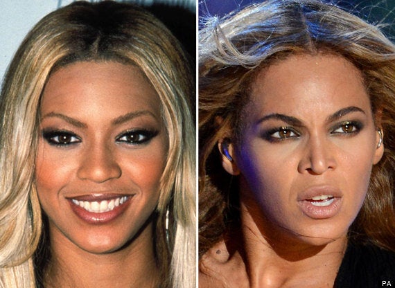 beyonce nose then and now