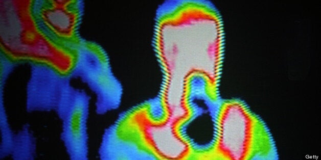 Thermal cameras