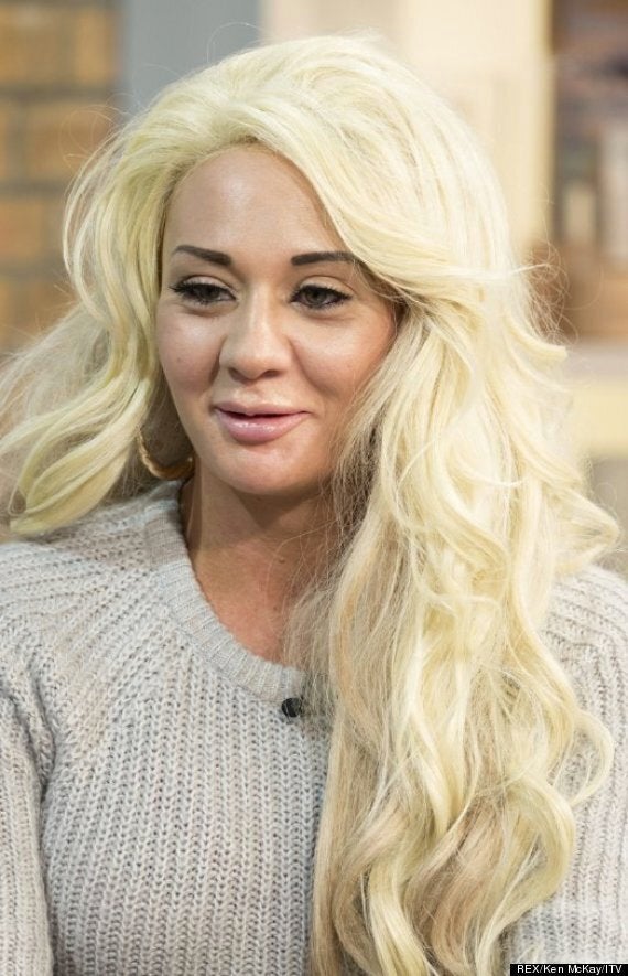 Josie Cunningham Will Nhs Boob Job Mum Live Up To Being The Most