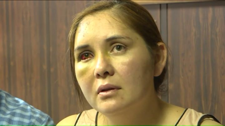 Beronica Ruiz says she was beaten unconscious by a 13-year-old boy who had been bullying her son at school, telling him to go back to Mexico.