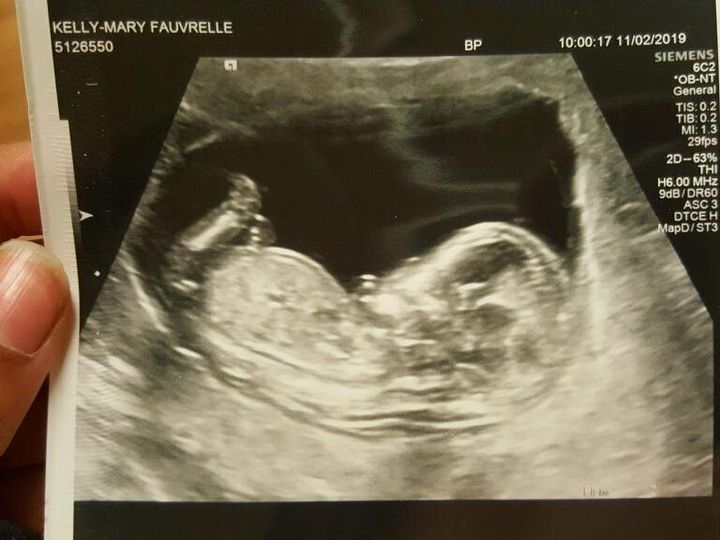 An ultrasound photograph posted on Facebook by Kelly-Mary Fauvrelle
