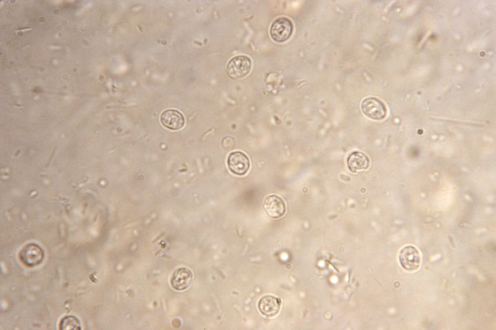 This 1983 microscope image provided by the Centers for Disease Control and Prevention shows Cryptosporidium parvum parasitic organisms in a stool smear specimen, the cause of a patient's cryptosporidiosis.