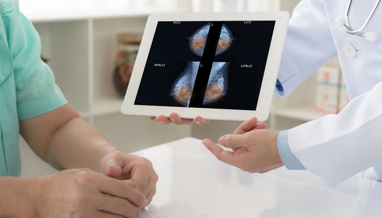 Implants mammaires: plusieurs milliers de Québécoises avisées d’un risque de
