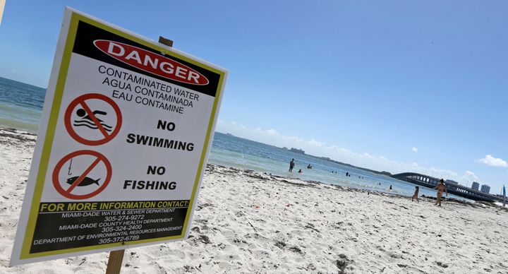 A swimming advisory posted at Miami's Hobie Beach in July 2016. 