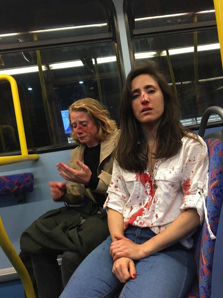 Melania Geymonat shared this photo of her and her date following the May 30 assault on a London bus. Four teenagers have since been charged in the attack.