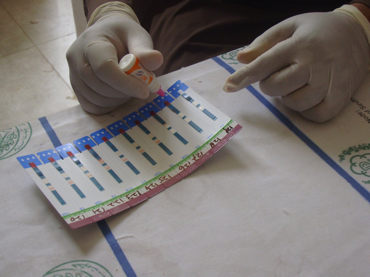 A health technician administers an HIV test. 