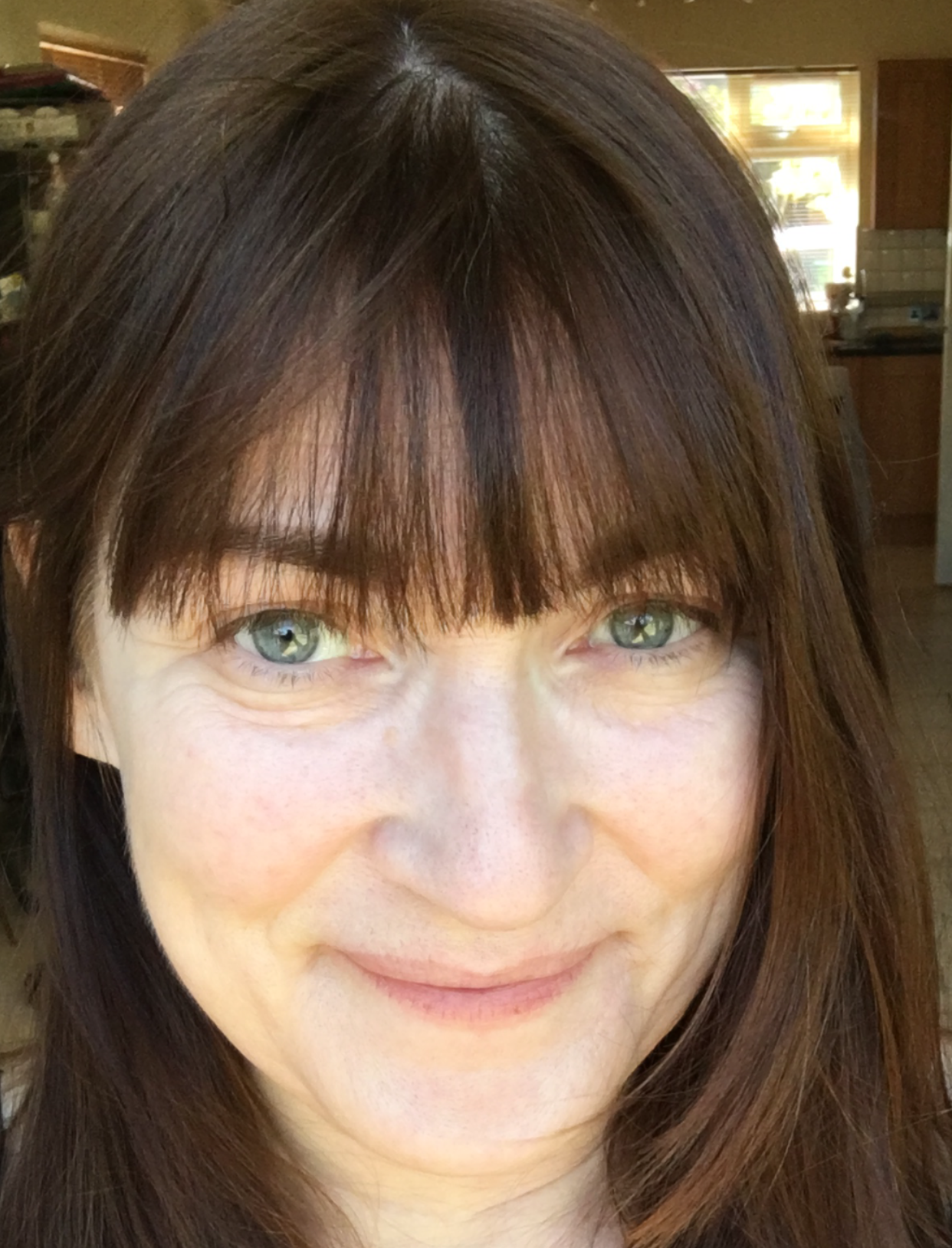 <strong>Nicky Clark was diagnosed with autism following an 18 month delay </strong>